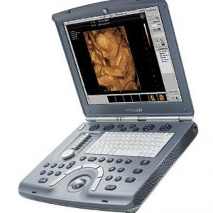GE Voluson i Ultrasound